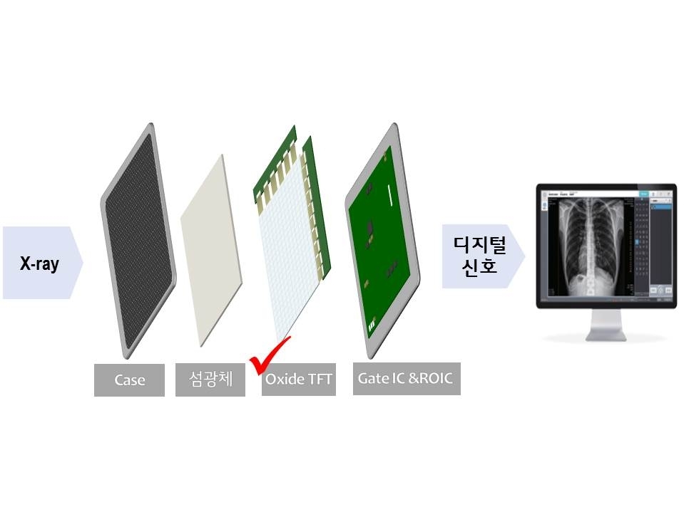 LG디스플레이, 고부가가치 의료용 엑스레이 영상 신시장 진출